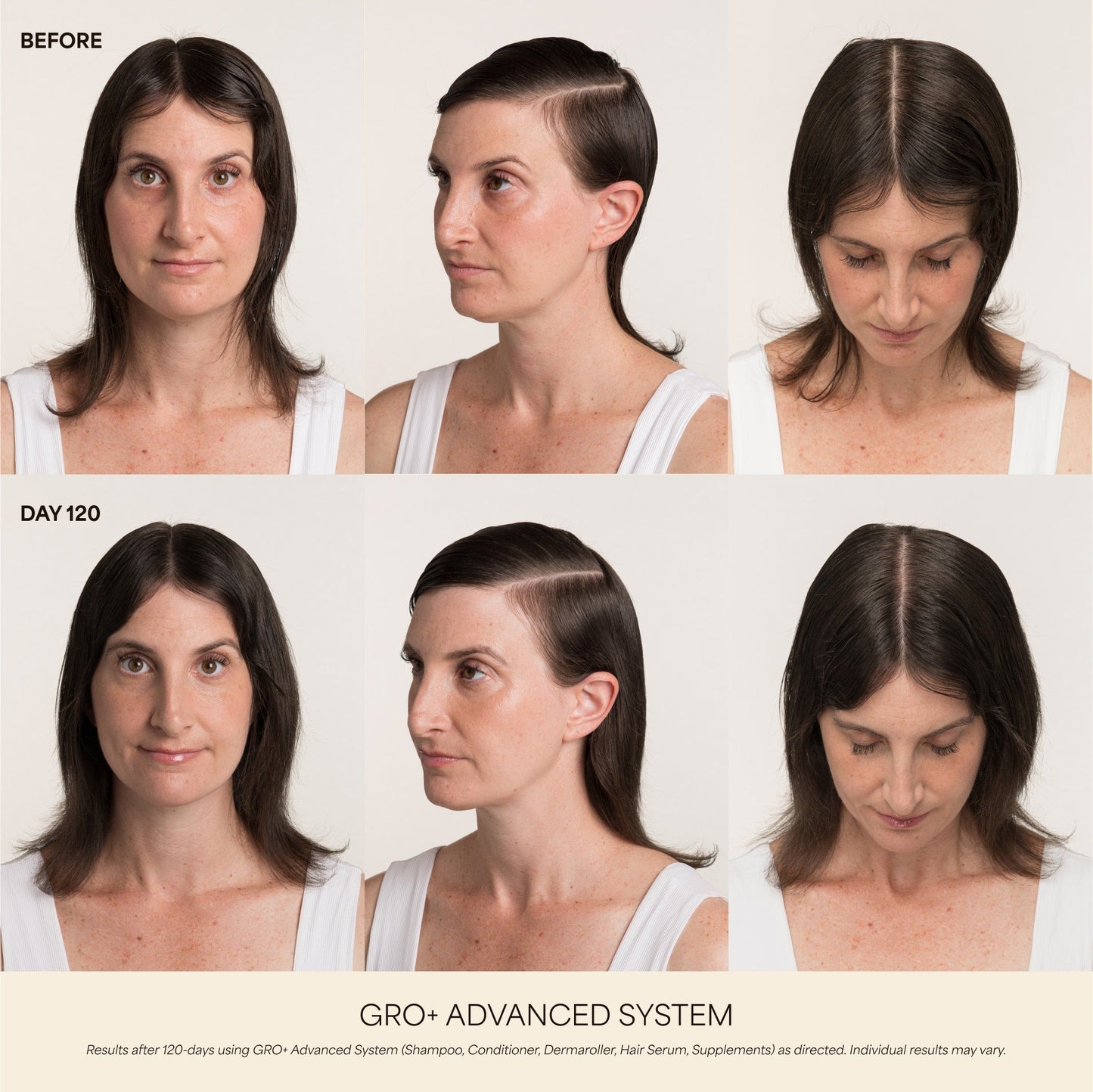 💰 80% OFF ✨ Next-Gen Advanced Hair Serum – Grab Yours Now!