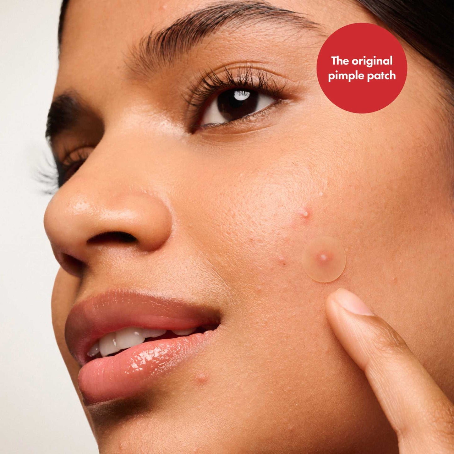 ✨ Mighty Patches™ Original – Invisible Zit Hero ✨