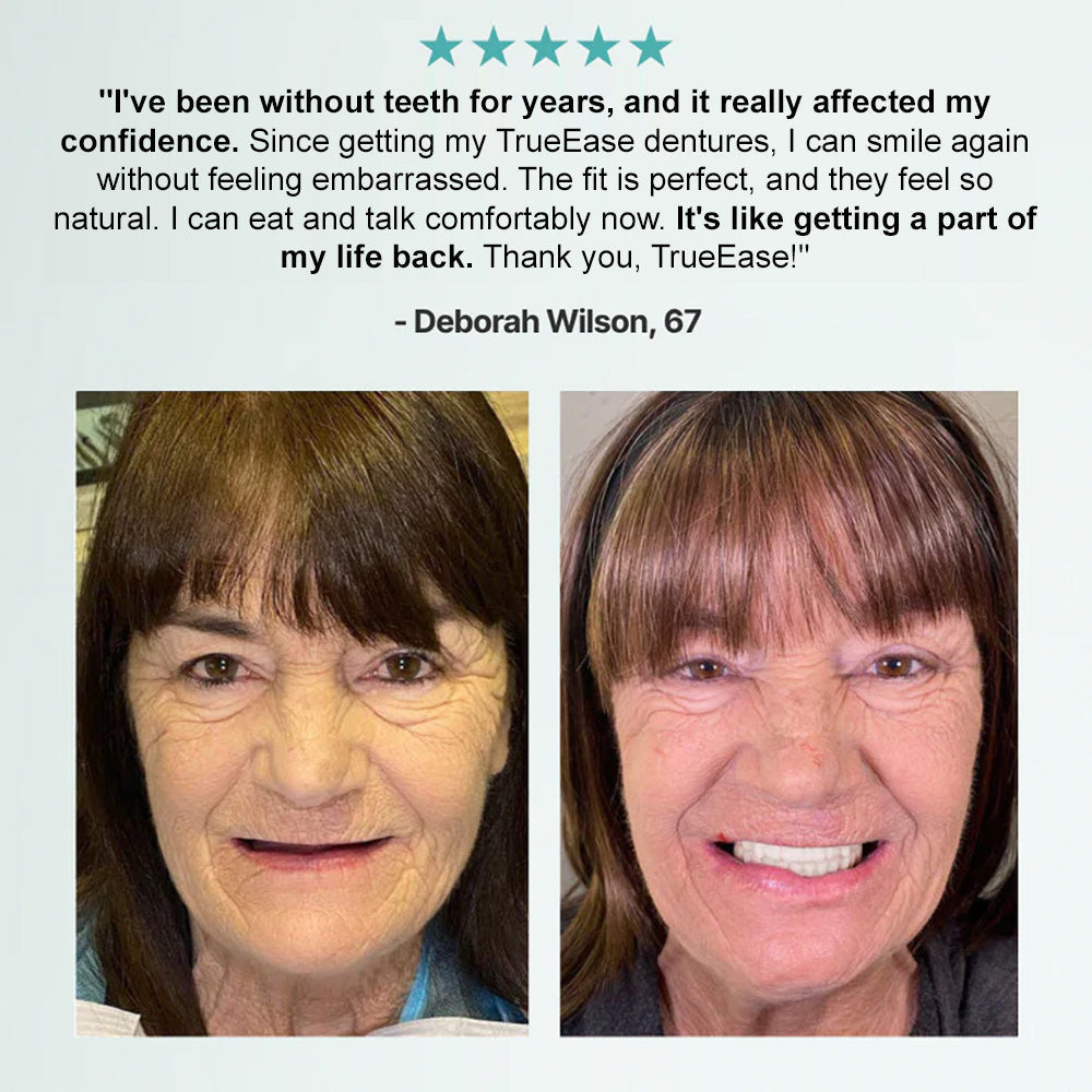 Hermsa® Advanced Customized Full Denture Set(✅Clinically backed comfort-fit dentures — Trusted by 8,000+ US users for all-day comfort.)