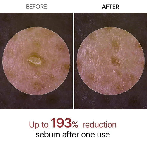 Final 3 Hours: 60% OFF🔥 Gentle Exfoliator Glow Rice Ampoule-Suitable for All Skin Types