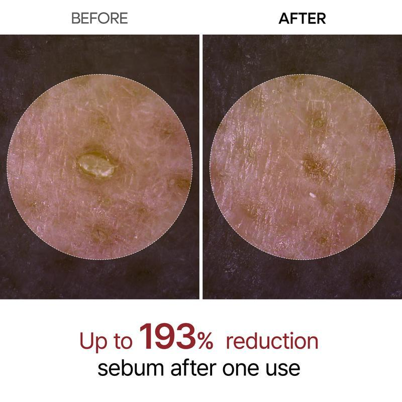 ๐Dr.Malexin Peel Shot Glow Rice Ampoule Duo