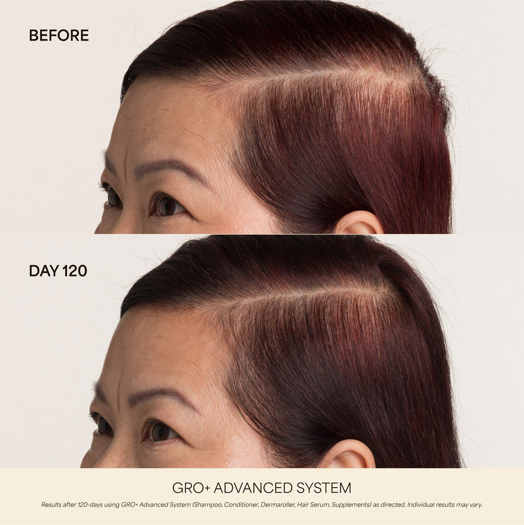 💰 80% OFF ✨ Next-Gen Advanced Hair Serum – Grab Yours Now!