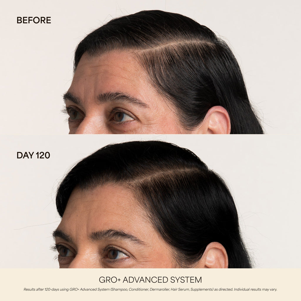 💰 80% OFF ✨ Next-Gen Advanced Hair Serum – Grab Yours Now!