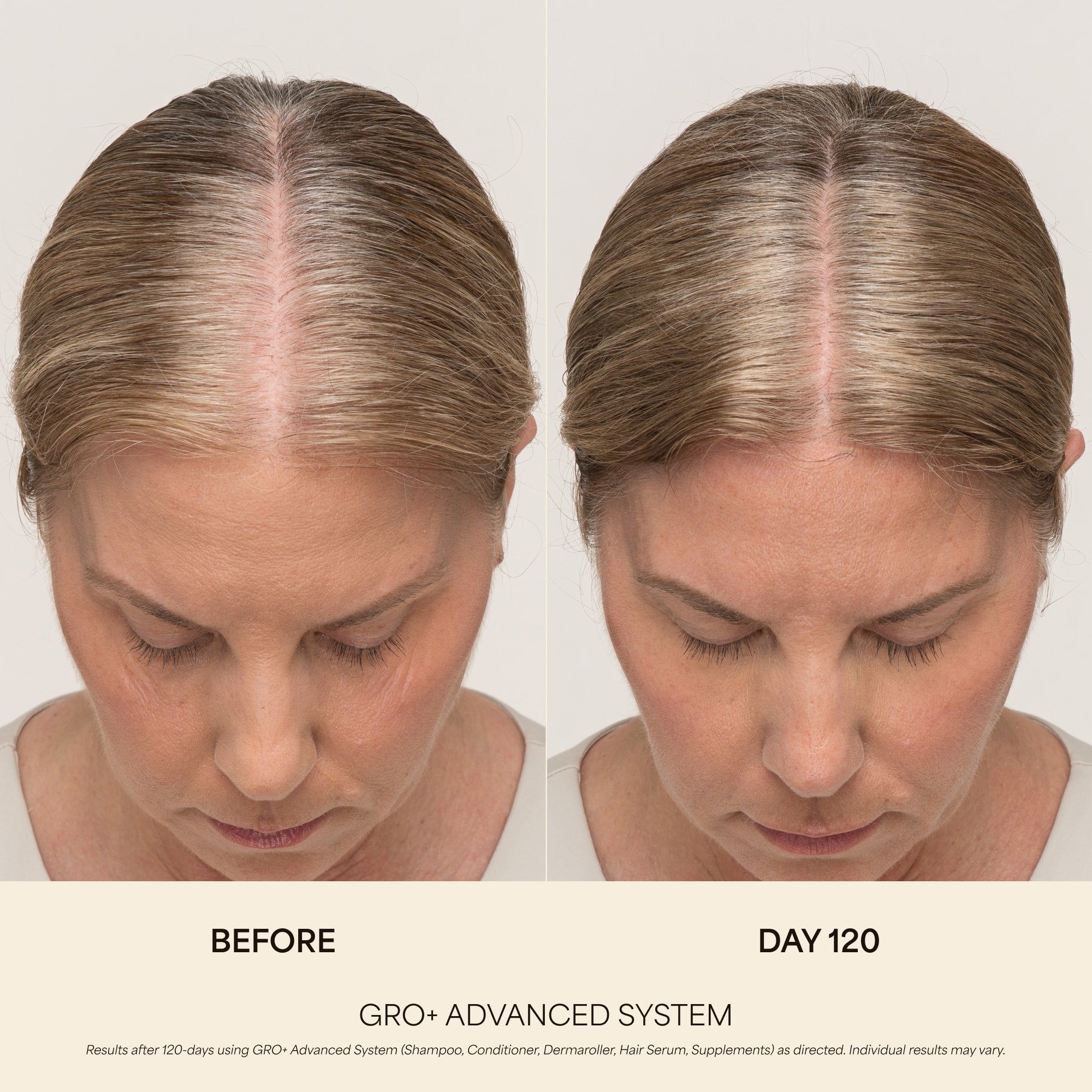 💰 80% OFF ✨ Next-Gen Advanced Hair Serum – Grab Yours Now!