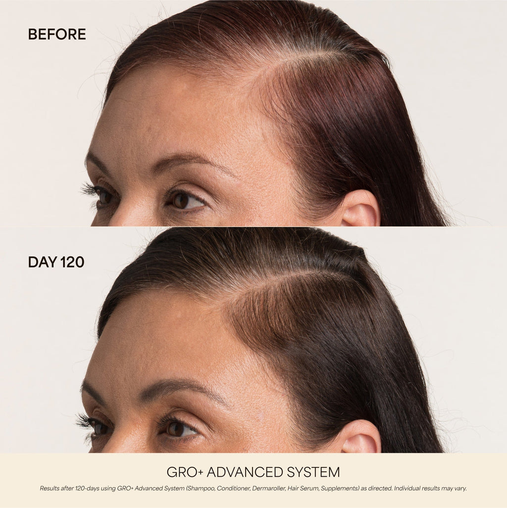 💰 80% OFF ✨ Next-Gen Advanced Hair Serum – Grab Yours Now!