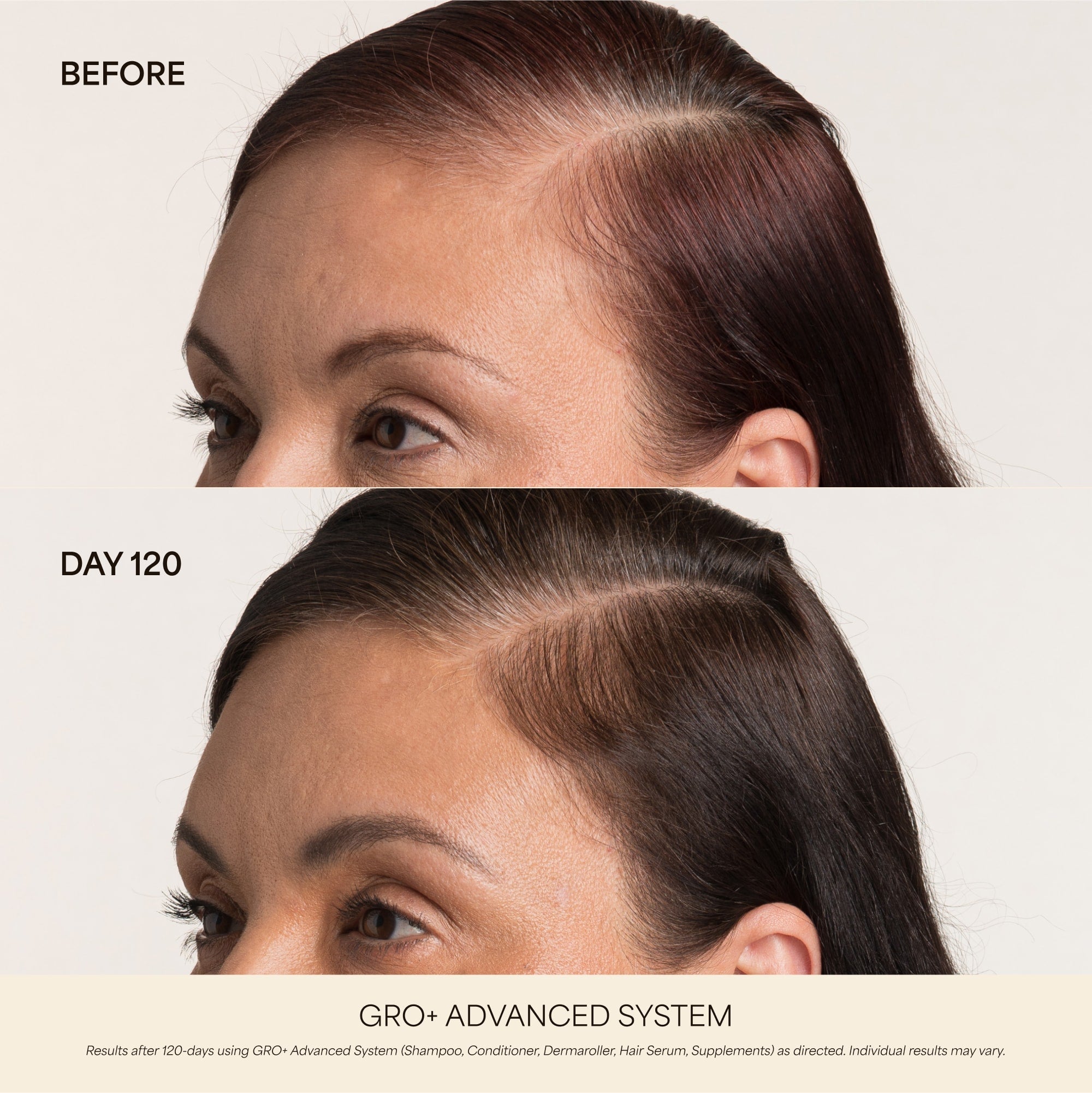 💰 80% OFF ✨ Next-Gen Advanced Hair Serum – Grab Yours Now!