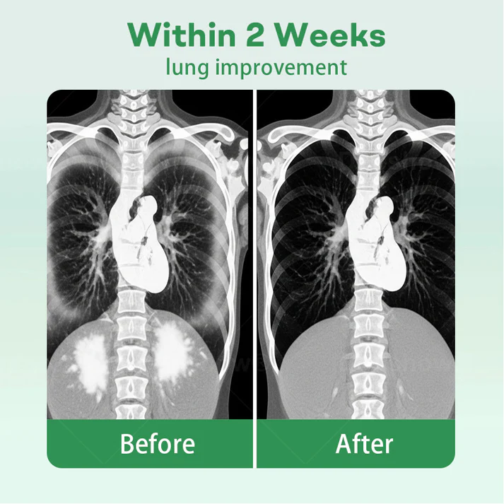 🔥Mullein Aroma Air Scentor – Relief for Cough, Congestion & Breathing Comfort2.0💝