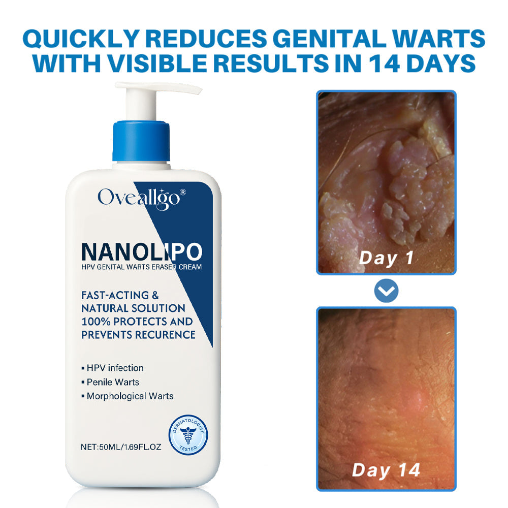 💰 80% OFF 💎 NanoLip  ProX Genital Warts Eraser Cream