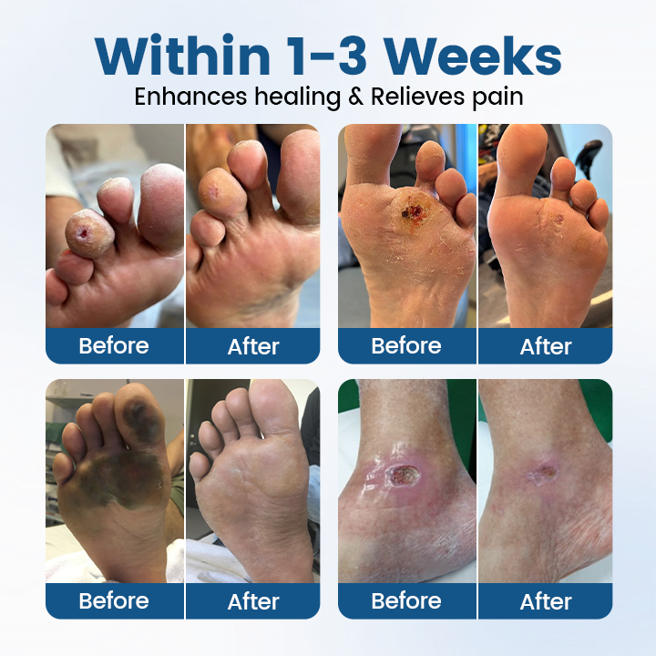 BBOJI® AngioVita Diabetic Care Spray