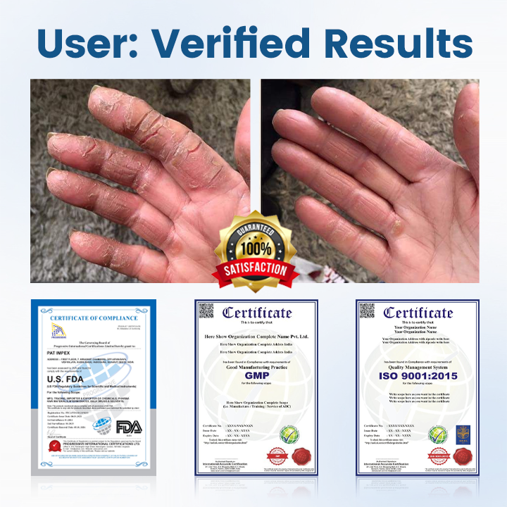 BBOJI® AngioVita Diabetic Care Spray