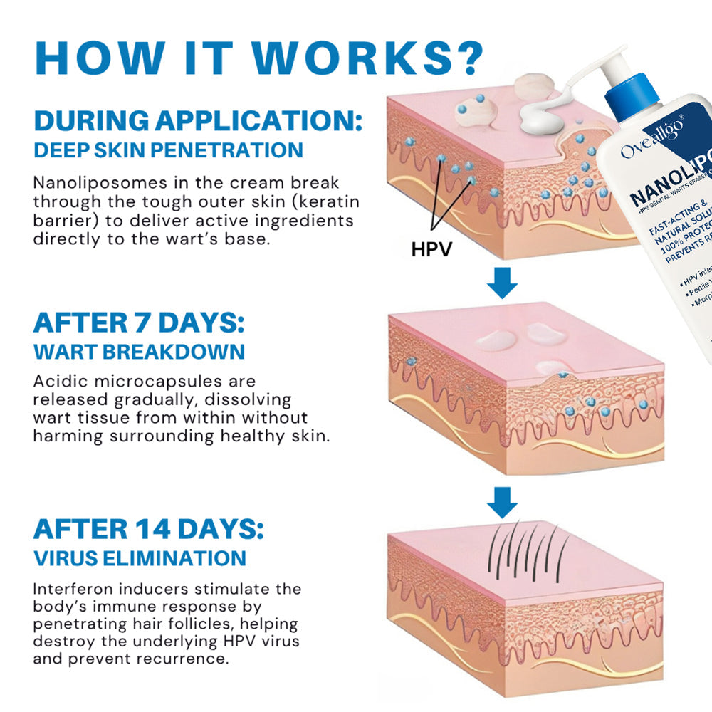 💰 80% OFF 💎 NanoLip  ProX Genital Warts Eraser Cream