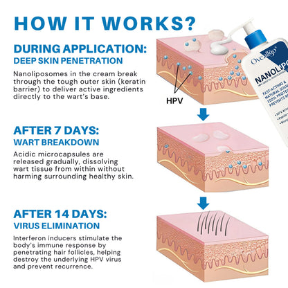 💰 80% OFF 💎 NanoLip  ProX Genital Warts Eraser Cream