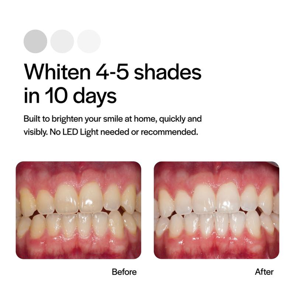 🔥Today 60% OFF🔥Opelascence Go Teeth Whitening Trays - 15% Hydrogen Peroxide Oral Gel - (10 Treatments) Ultradent Products. Teeth Whitening Kit - Mint