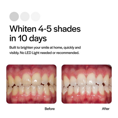 🔥Today 60% OFF🔥Opelascence Go Teeth Whitening Trays - 15% Hydrogen Peroxide Oral Gel - (10 Treatments) Ultradent Products. Teeth Whitening Kit - Mint