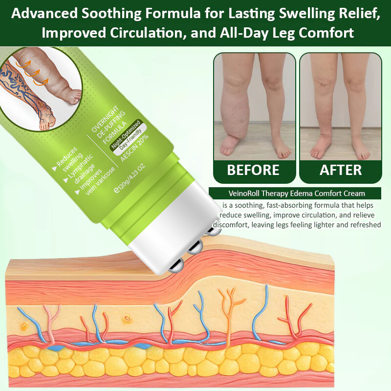Oveallgo® VeinoRoll Therapy Edema Comfort Cream