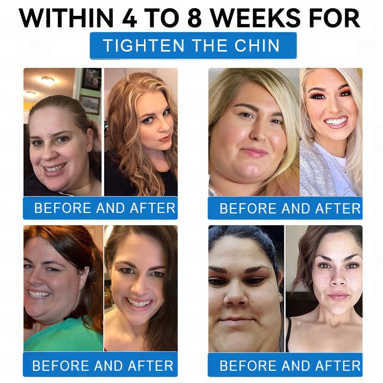 🔥 Best Seller-LBMLBM® SMGT-GLP-1 𝐓𝐢𝐫𝐳𝐞𝐩𝐚𝐭𝐢𝐝𝐞 & 𝐂𝐨𝐥𝐥𝐚𝐠𝐞𝐧 𝐍𝐚𝐧𝐨 𝐌𝐢𝐜𝐫𝐨𝐧𝐞𝐞𝐝𝐥𝐞 𝐖𝐞𝐢𝐠𝐡𝐭 𝐋𝐨𝐬𝐬 𝐏𝐚𝐭𝐜𝐡丨Targets Obesity, Loose Skin, High Blood Pressure, Diabetes, Fatty Liver, Joint Pain, Brain Fog, Low Energy, Body Aches, and More