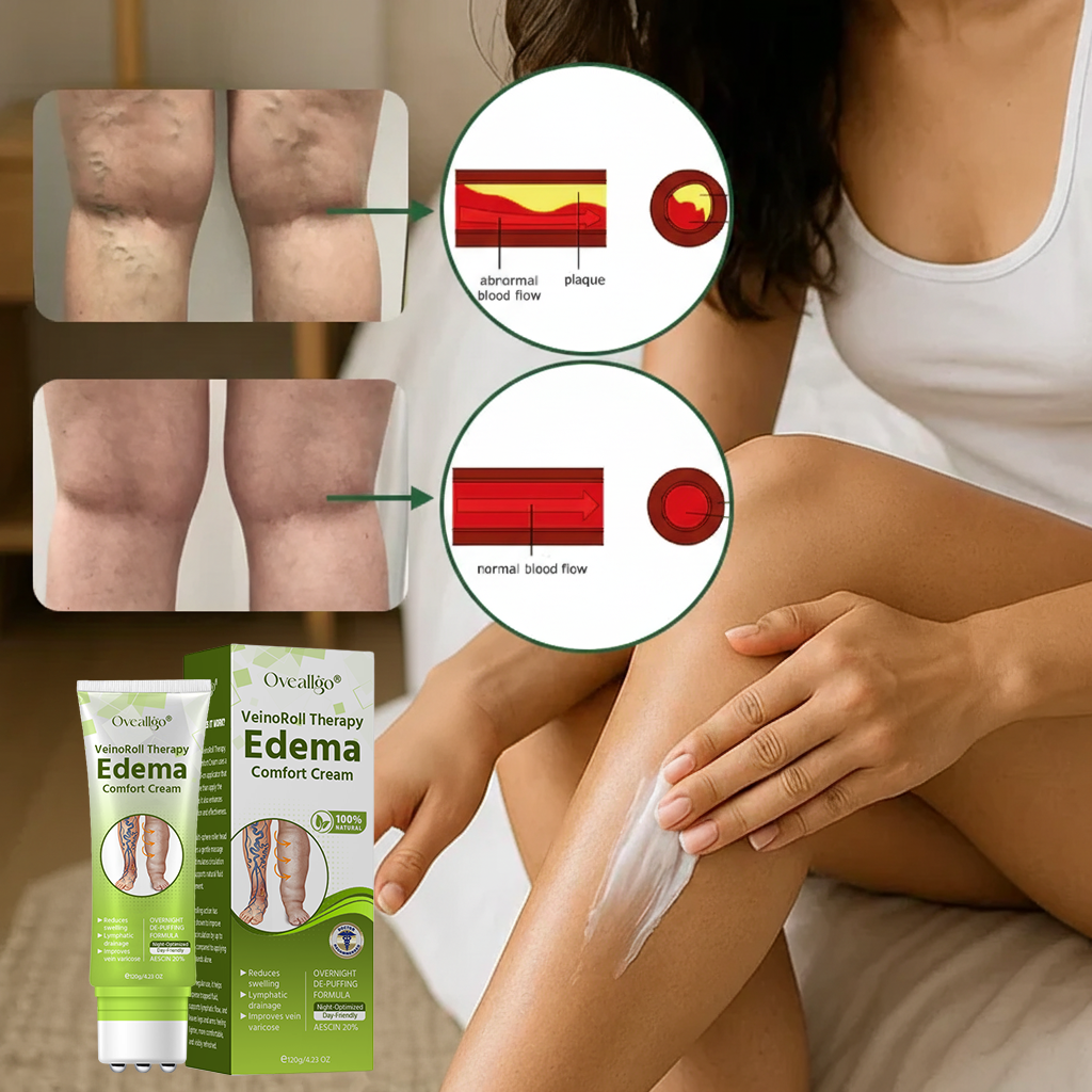 Oveallgo® VeinoRoll Therapy Edema Comfort Cream