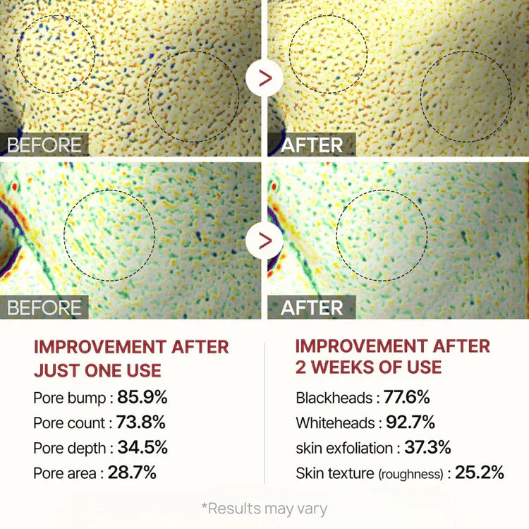 Final 3 Hours: 60% OFF🔥 Gentle Exfoliator Glow Rice Ampoule-Suitable for All Skin Types