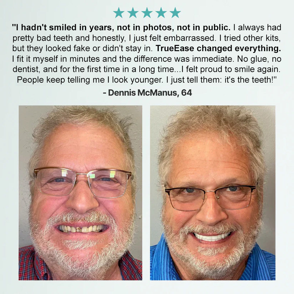 Hermsa® Advanced Customized Full Denture Set（✅Clinically backed comfort-fit dentures —  Trusted by 8,000+ US users for all-day comfort.）