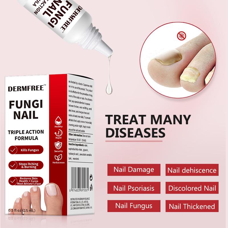 🌟 Buy One Get One Free – Toenail Fungus Treatment Extra Strength 🌟
