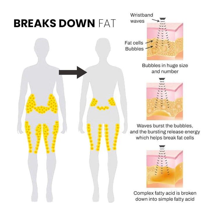 🔥LAST DAY 70% OFF)Slimoly™ Matteo Ultrasonic Body Shape Wristband Pro 🔥