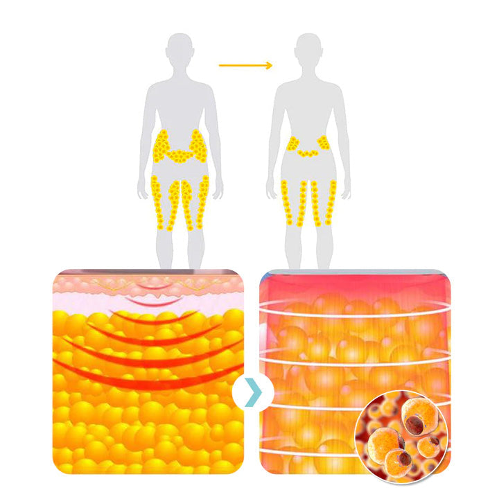 🔥LAST DAY 70% OFF)Slimoly™ Matteo Ultrasonic Body Shape Wristband Pro 🔥