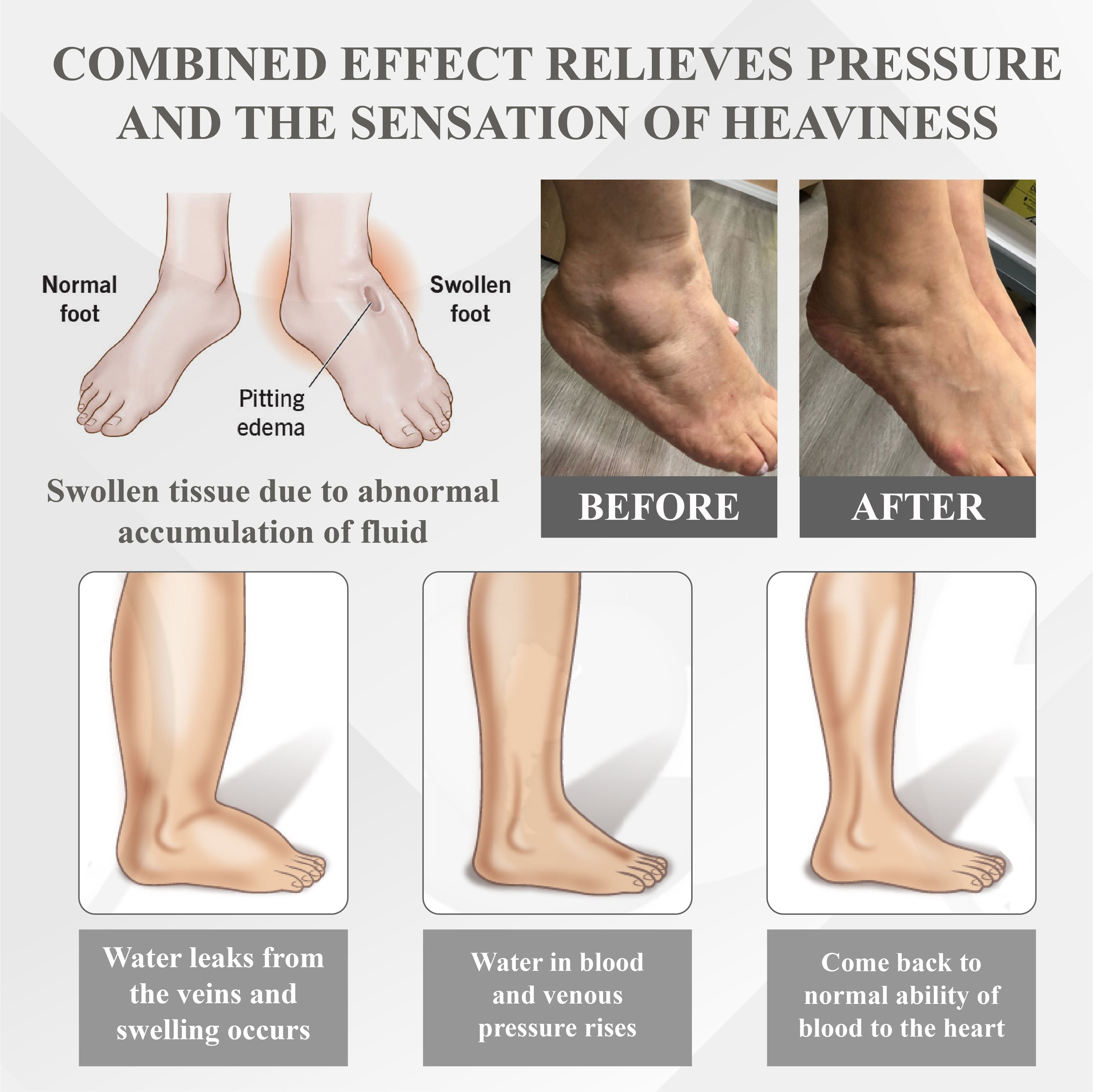 RICPIND® RedHeat EMS EdemaDrain Leg Massager