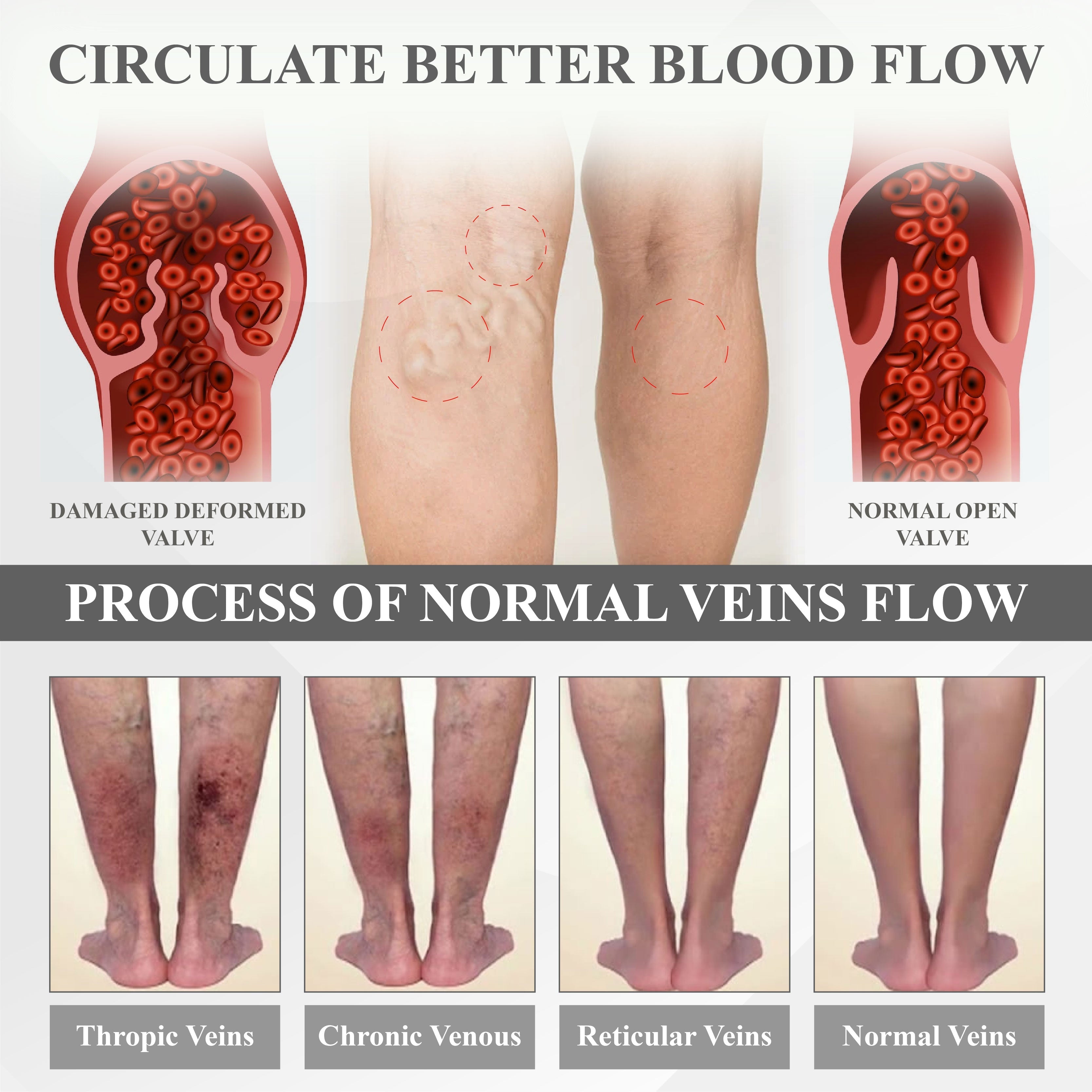 RICPIND® RedHeat EMS EdemaDrain Leg Massager