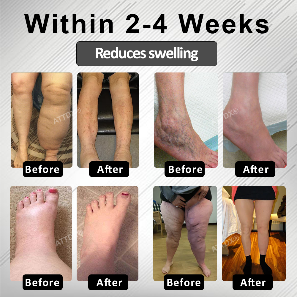 RICPIND® RedHeat EMS EdemaDrain Leg Massager