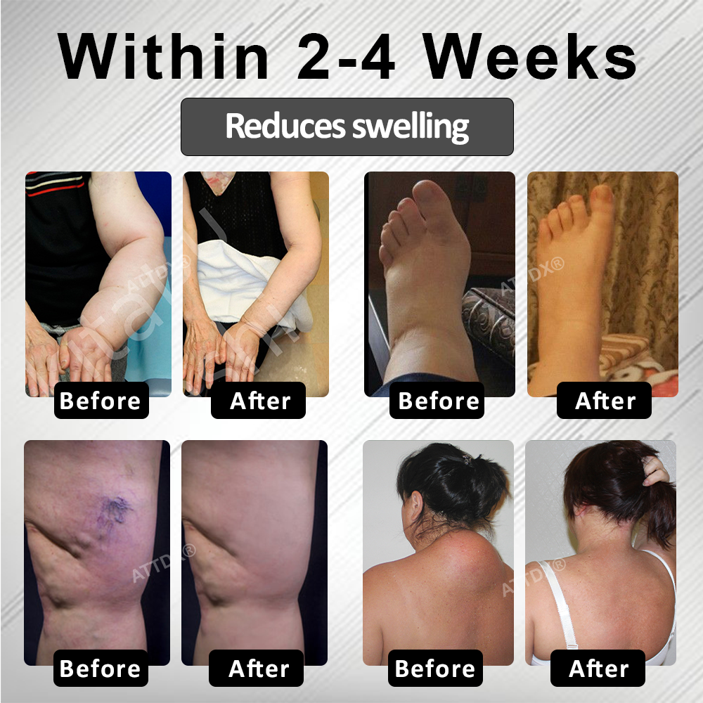 RICPIND® RedHeat EMS EdemaDrain Leg Massager